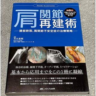 肩関節再建術 腱板断裂，肩関節不安定症の治療戦略(健康/医学)