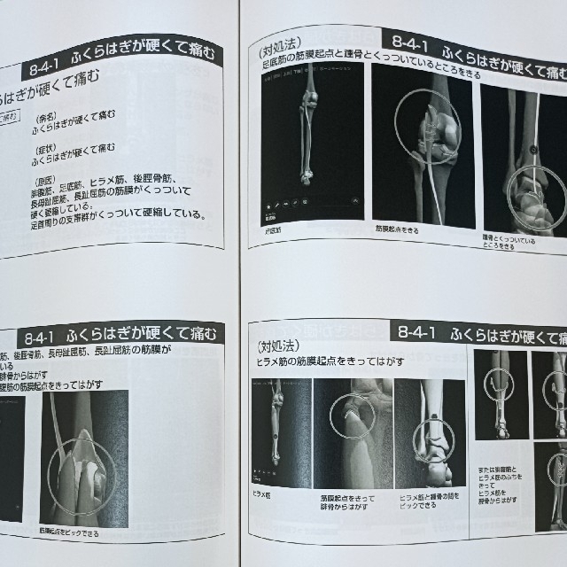 天城流医学大全集 脚・足首の痛み編 杉本錬堂 筋膜 整体 DVD 天城流医学大全集 脚・足首の痛み編 杉本錬堂 筋膜 整体 DVD