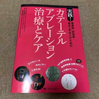 カテーテルアブレーション治療とケア(健康/医学)