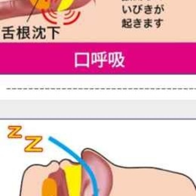 【効果抜群】　いびき防止サポーター　男女兼用　歯ぎしり矯正 顔やせ効果 コスメ/美容のオーラルケア(口臭防止/エチケット用品)の商品写真