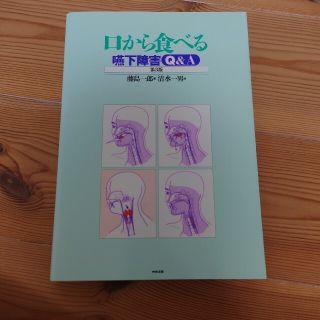 口から食べる嚥下障害Q&A(健康/医学)