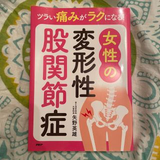 ツラい痛みがラクになる！女性の変形性股関節症(健康/医学)