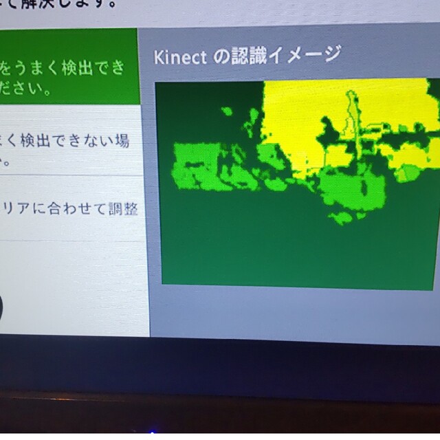 Xbox360(エックスボックス360)のKinectセット　XBOX360用 エンタメ/ホビーのゲームソフト/ゲーム機本体(その他)の商品写真