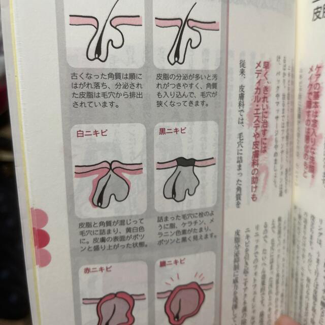 正しい美肌スキンケア 皮膚科医おすすめ エンタメ/ホビーの本(その他)の商品写真