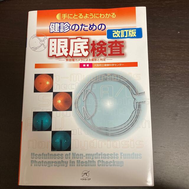 手にとるようにわかる健診のための眼底検査 無散瞳カメラによる撮影と判定 改訂版 エンタメ/ホビーの本(健康/医学)の商品写真