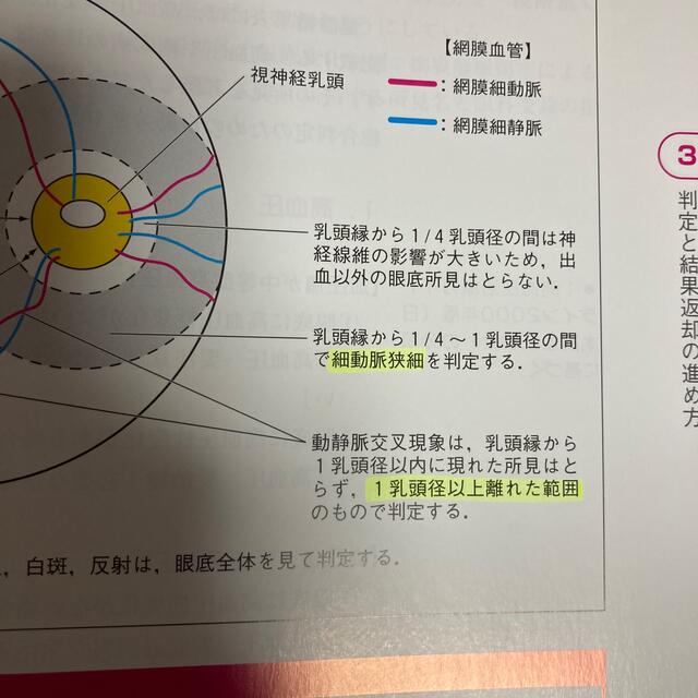 手にとるようにわかる健診のための眼底検査 無散瞳カメラによる撮影と判定 改訂版 エンタメ/ホビーの本(健康/医学)の商品写真