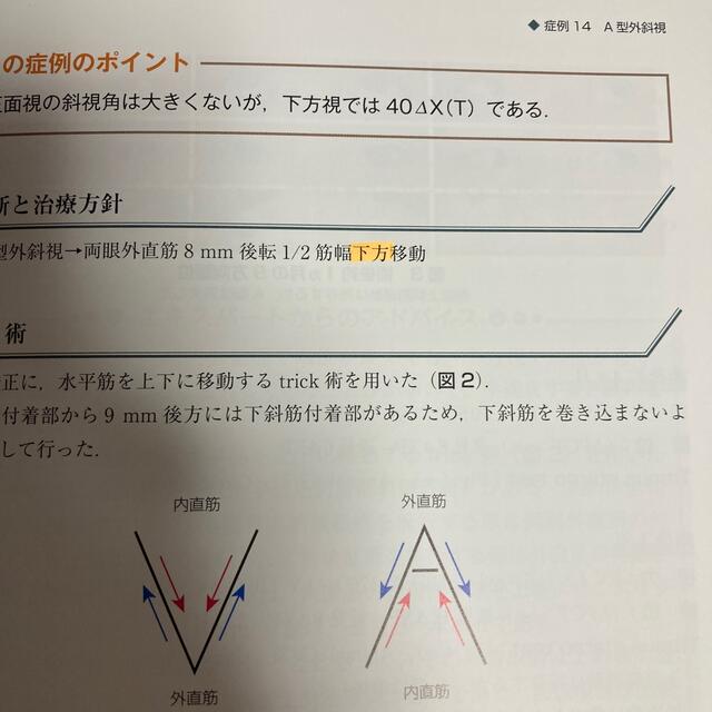 斜視治療のストラテジー 症例検討で学ぶエキスパートの思考と対処法 エンタメ/ホビーの本(健康/医学)の商品写真