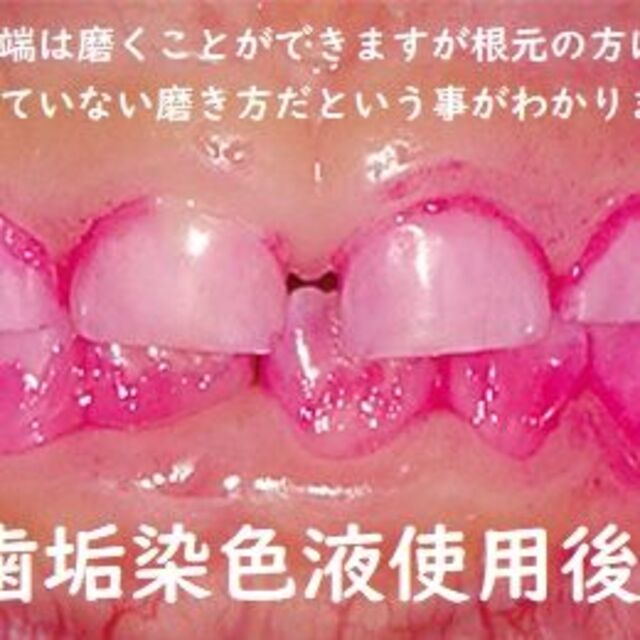 知覚過敏の人の為のお試し歯磨きセット コスメ/美容のオーラルケア(歯ブラシ/デンタルフロス)の商品写真