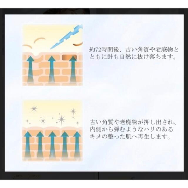 最終価格!いま人気の高濃度マイクロニードルスピキュールゲル SPIQRIE