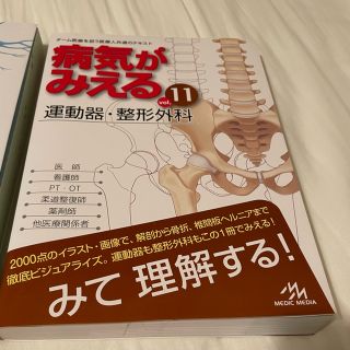 病気がみえるvol11運動器・整形外科(健康/医学)