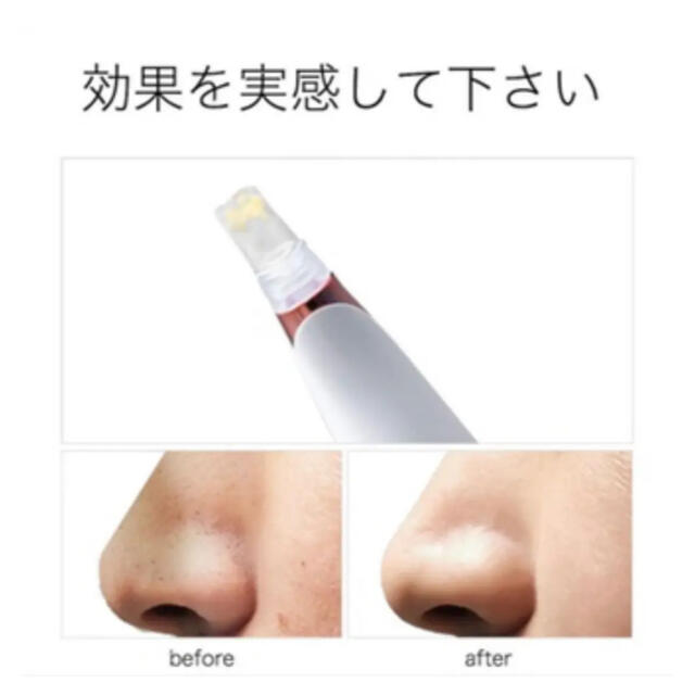 毛穴吸引器 スマホ/家電/カメラの美容/健康(フェイスケア/美顔器)の商品写真