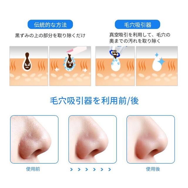 電動　角栓取り　毛穴除去 コスメ/美容のスキンケア/基礎化粧品(その他)の商品写真