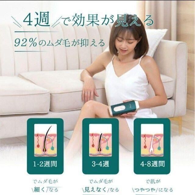 Omuse 光美容器 脱毛器 IPL光脱毛 全身脱毛　白