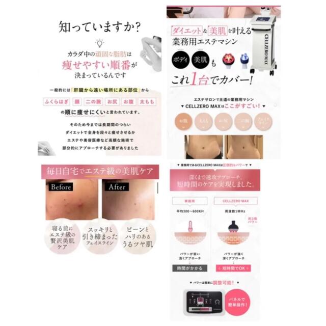 人気‼️セルゼロマックス 痩身エステ 美容機器 ラジオ波 人気‼️セルゼロマックス 痩身エステ 美容機器 ラジオ波