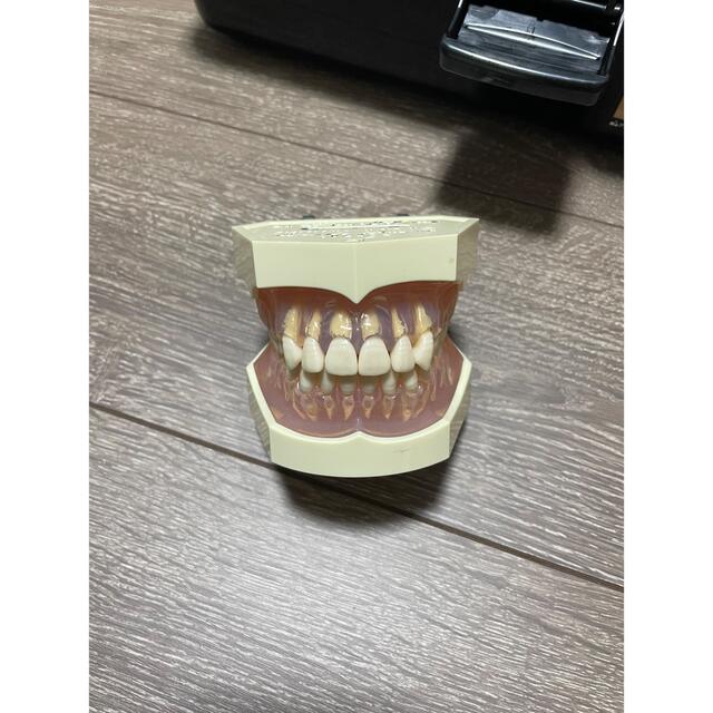 歯科用模型