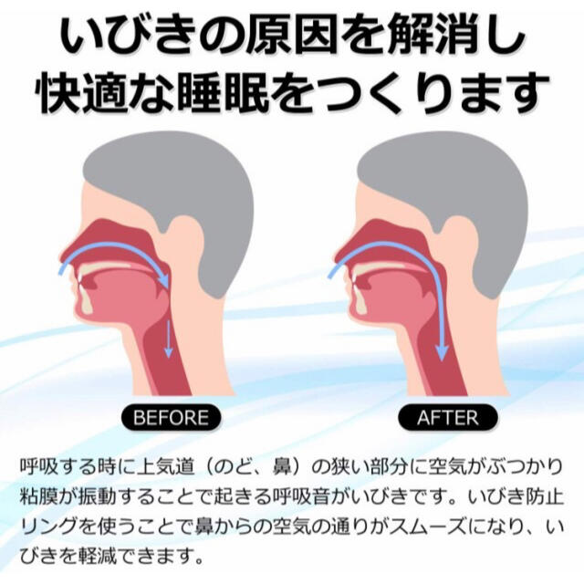 いびき防止リング　歯ぎしりいびき防止マウスピース　いびき防止グッズ　安眠　快眠 コスメ/美容のリラクゼーション(その他)の商品写真