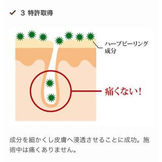 アマロスOHLハーブピーリング セルフエステ5回分 ☆説明書付きの通販