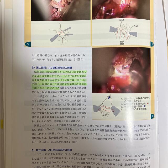 脳神経外科手術の基本手技 糸結びからクリッピングまで - 健康/医学