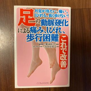 足の動脈硬化による痛み、しびれ、歩行困難これで改善(健康/医学)