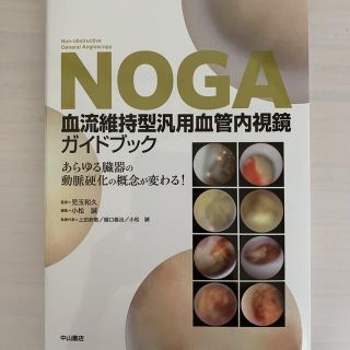 ＮＯＧＡ血流維持型汎用血管内視鏡ガイドブック あらゆる臓器の動脈硬化の概念が変わ(健康/医学)