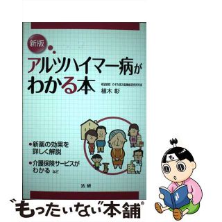 【中古】 アルツハイマー病がわかる本 新版/法研/植木彰(健康/医学)