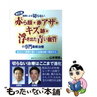 【中古】 医師による切らない「赤ら顔・赤アザ・キズ跡・浮き出た青い血管」の専門最新治療 改訂版/白誠書房/山本博意(健康/医学)