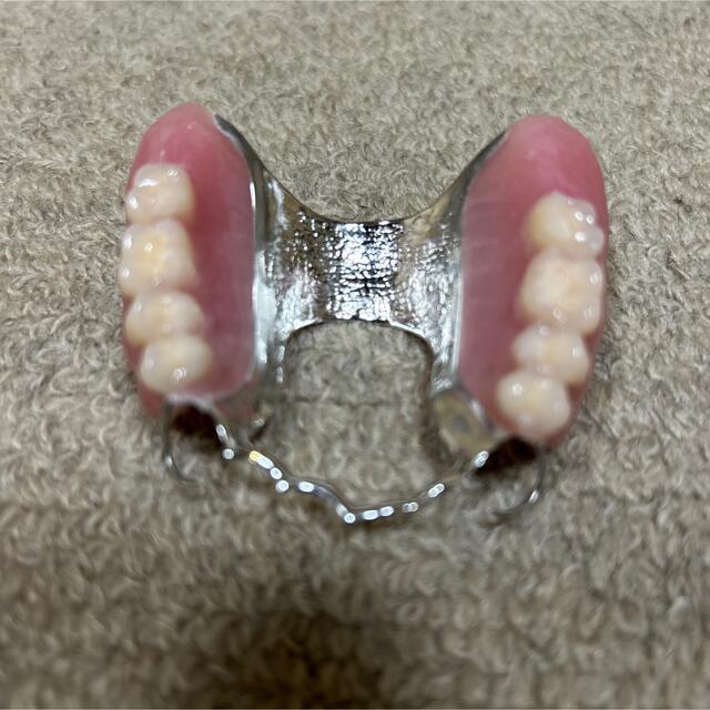 歯科用金属床義歯　サンプル模型