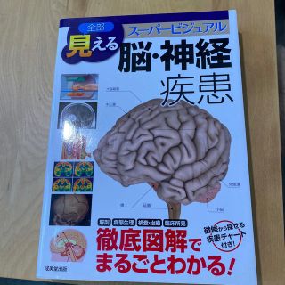 全部見える脳・神経疾患 ス－パ－ビジュアル(健康/医学)