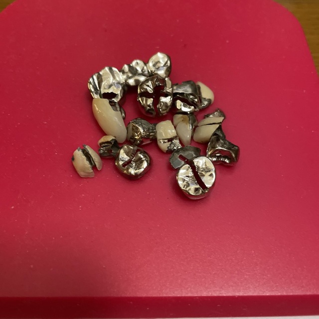 歯科 金属 除去冠 パラジウム 金パラ25g