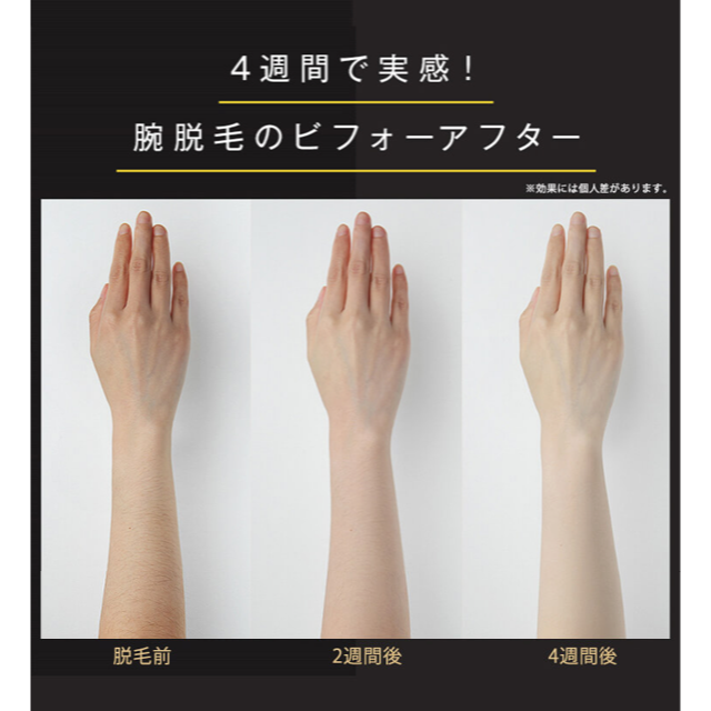◇JOVS Dora◇脱毛器 2022年最新版 エメラルドグリーン 新品未開封品