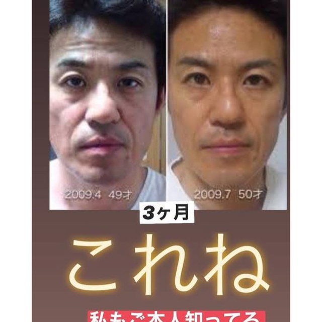 メディシュティーク 炭酸パック 10回分 世界一の炭酸パック 正規品