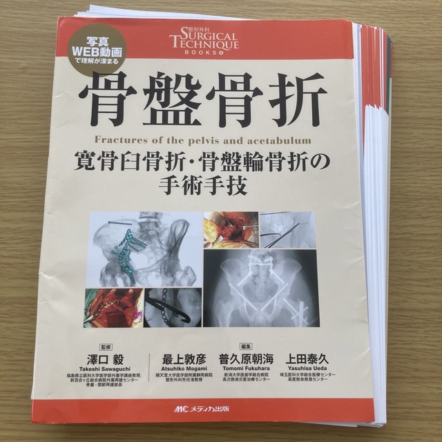 骨盤骨折 寛骨臼骨折・骨盤輪骨折の手術手技【裁断済み】手術