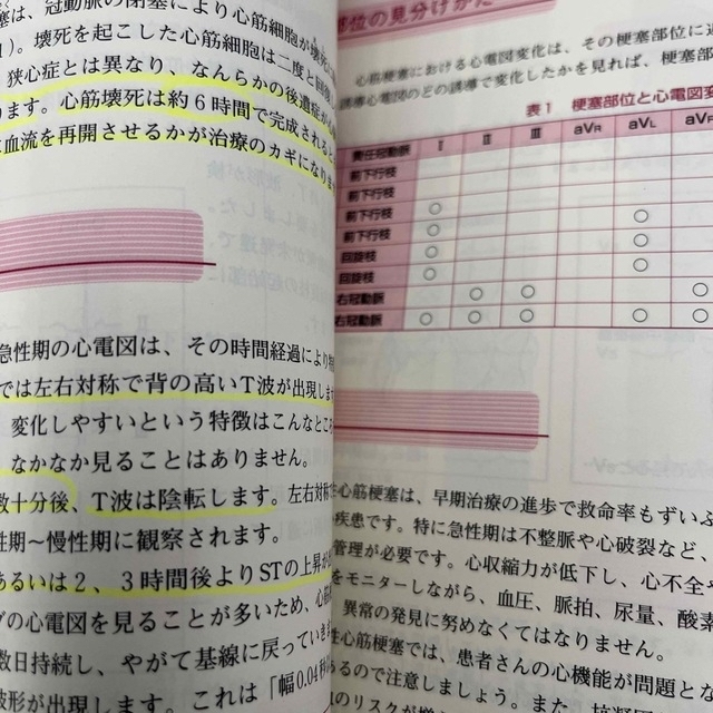 もう忘れない！早わかり心電図 たとえで覚える心臓の動きと心電図の読みかた エンタメ/ホビーの本(健康/医学)の商品写真