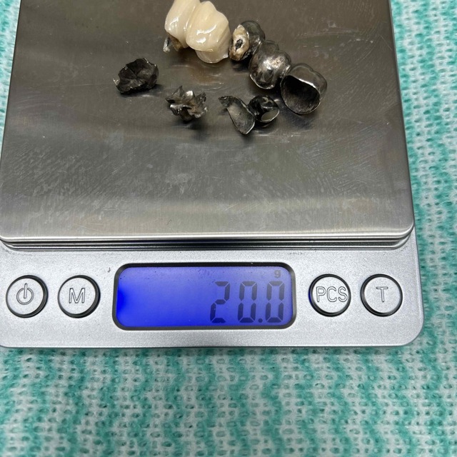 金属工芸歯科撤去冠　19.9g〜20.0g 金銀パラジウム合金