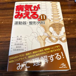 病気がみえる ｖｏｌ．１１ 運動器・整形外科(健康/医学)