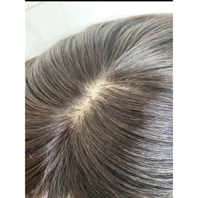 レミー人毛100% 二重引き抜き植毛 前髪から隠せて自然 【日本 レミー人毛100% 二重引き抜き植毛 前髪から隠せて自然 【日本