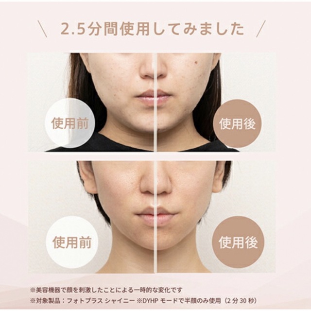 新品未開封】 ヤーマン フォトプラス シャイニー BeautyBox | www