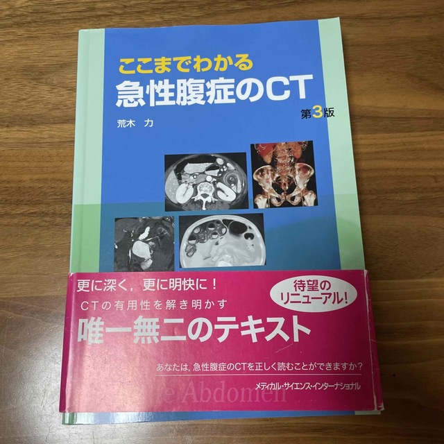 ここまでわかる急性腹症のCT 第3版の通販 by ryu0317's shop|ラクマ