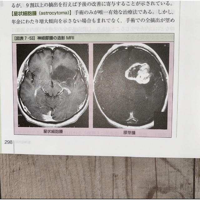 新看護観察のキーポイントシリーズ　脳神経外科 （新看護観察のキーポイントシリーズ エンタメ/ホビーの本(健康/医学)の商品写真