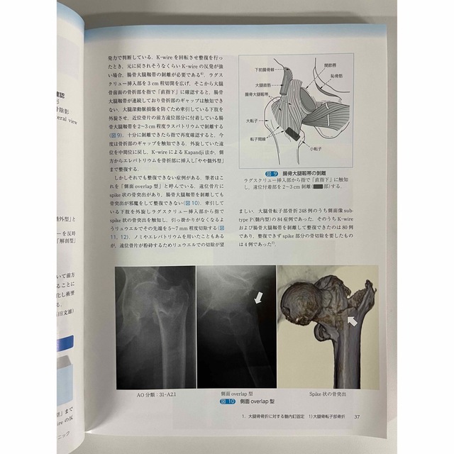 髄内釘による骨接合術 エンタメ/ホビーの本(健康/医学)の商品写真