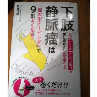 下肢静脈瘤は「足の甲テーピング」で９割よくなる！ 足のむくみ・こむら返りは“抜け(健康/医学)