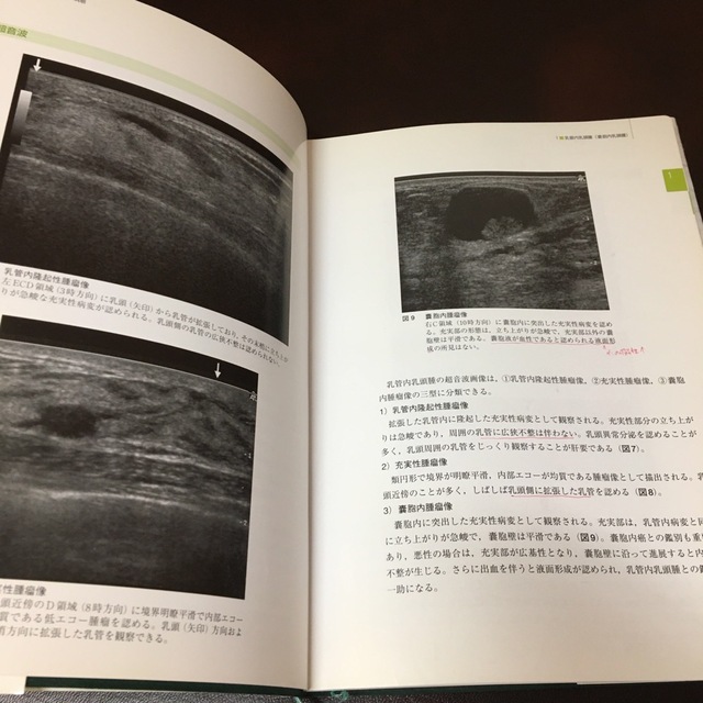 乳腺の組織型診断とその病態 エンタメ/ホビーの本(健康/医学)の商品写真