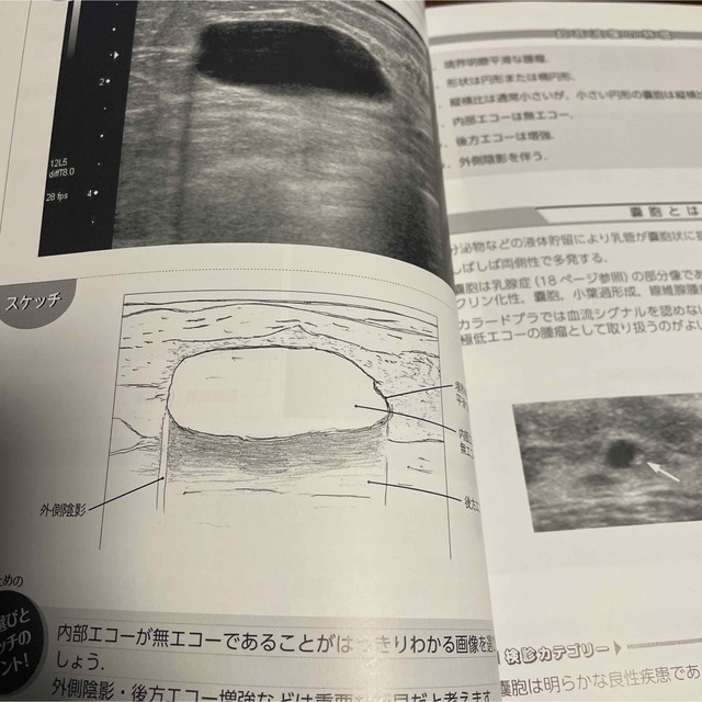 知っておきたい！乳房超音波画像とスケッチの書き方 エンタメ/ホビーの本(健康/医学)の商品写真