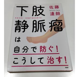 下肢静脈瘤は自分で防ぐ！こうして治す！(健康/医学)