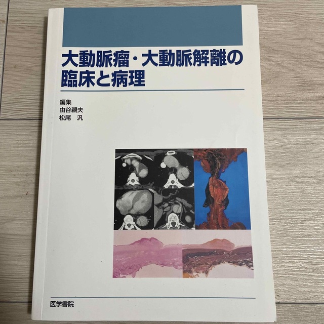 大動脈瘤・大動脈解離の臨床と病理