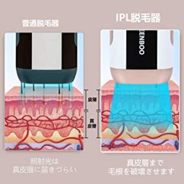 ⭐️新品未使用⭐️脱毛器 レーザー IPL光脱毛器 99万回照射 家庭用 男女 2