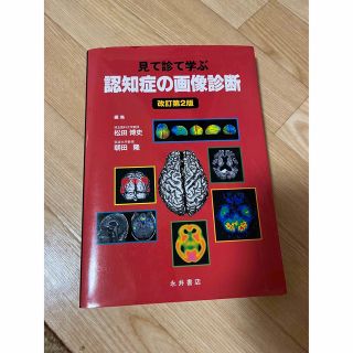 認知症の画像診断 見て診て学ぶ(健康/医学)