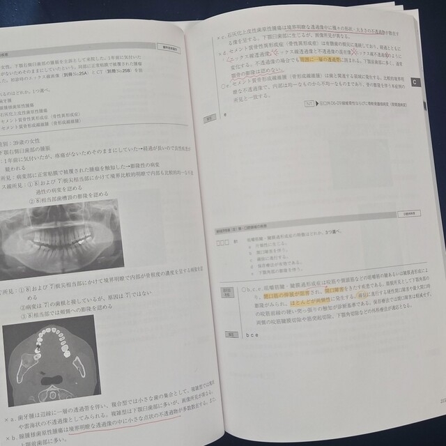 麻布デンタルアカデミー 116回0-3回 解答解説本、問題別冊、問題冊子 麻布デンタルアカデミー 116回0-3回 解答解説本、問題別冊、問題冊子