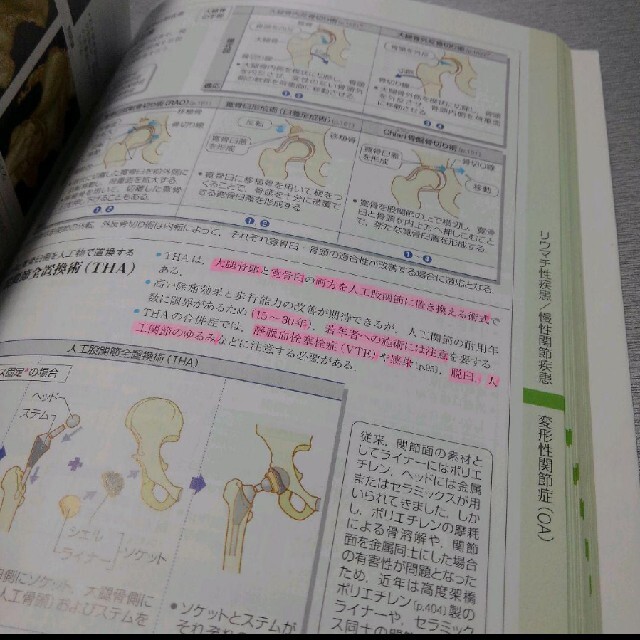 病気がみえる vol.11 エンタメ/ホビーの本(健康/医学)の商品写真