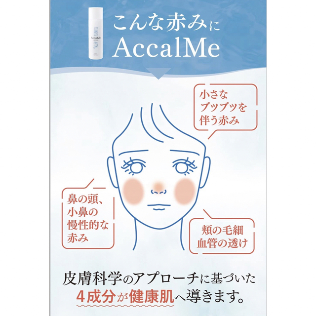 アカルミー化粧水　100ml 3